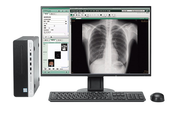 レントゲン装置CARNACORE